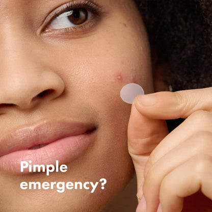 Hydrocolloid Acne Pimple Patch for Covering Zits and Blemishes - Saginaw Lane